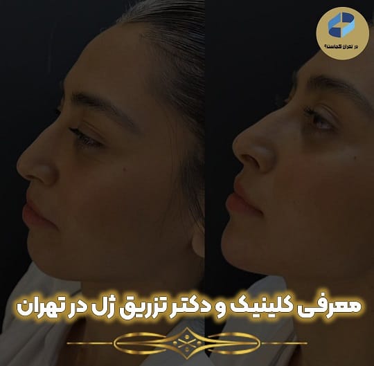 کلینیک تزریق ژل تهران