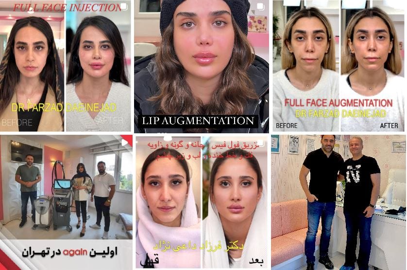 کلینیک تزریق ژل تهران