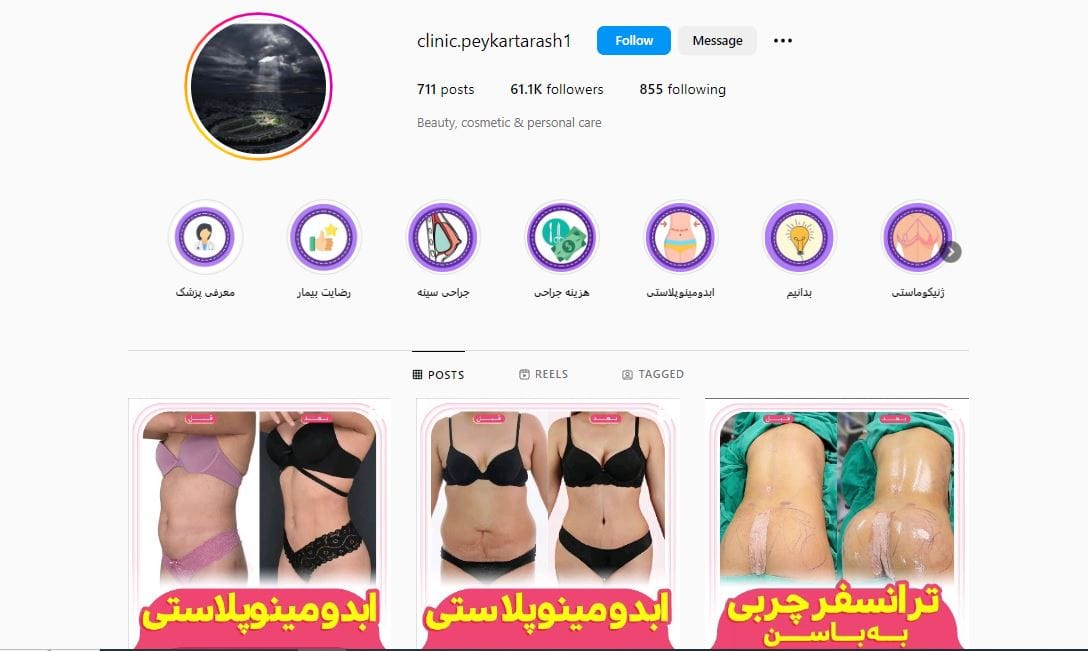 دکتر رقیه جلیلی جراح لیپوماتیک در تهران