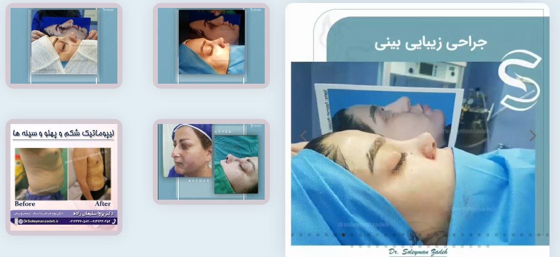 دکتر پژوا سلیمان زاده جراح لیپوماتیک