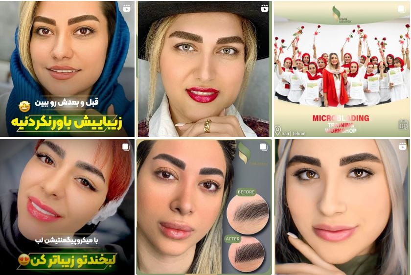 مرکز میکروبلیدینگ غزل زرگریان