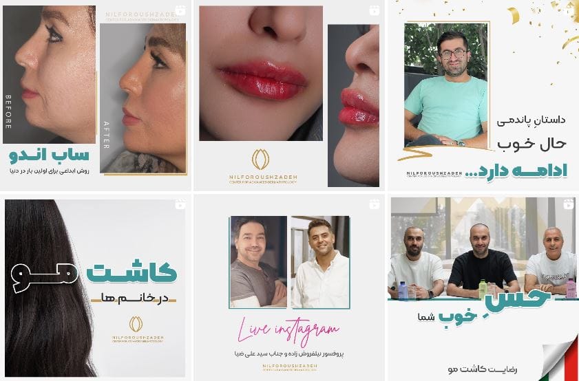 کلینیک دکتر نیلفروش زاده ژل لب