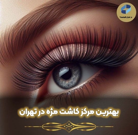 مرکز کاشت مژه در تهران