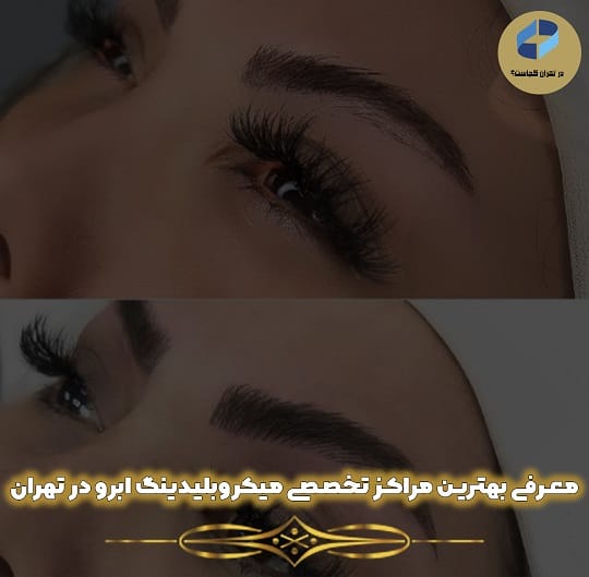 بهترین مرکز میکروبلیدینگ ابرو در تهران