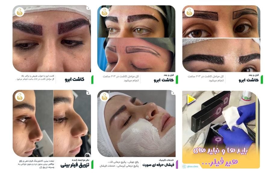 بهترین کلینیک های زیبایی شمال تهران