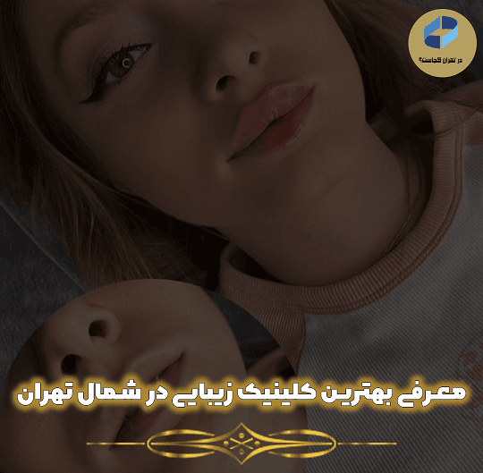 لینیک زیبایی در شمال تهران