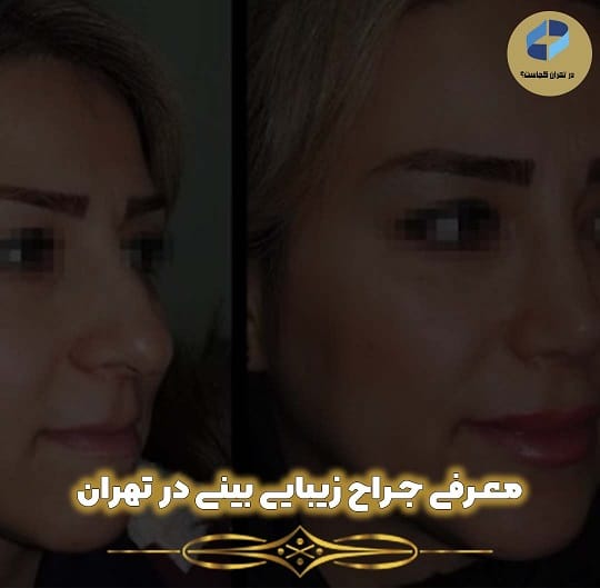 بهترین جراح بینی در تهران