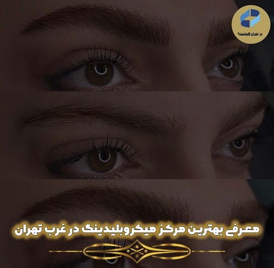بهترین مرکز میکروبلیدینگ در غرب تهران کجاست؟
