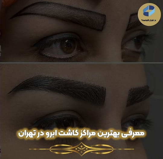 معرفی بهترین و متخصص ترین مرکز و کلینیک کاشت ابرو در تهران + مشخصات تماس