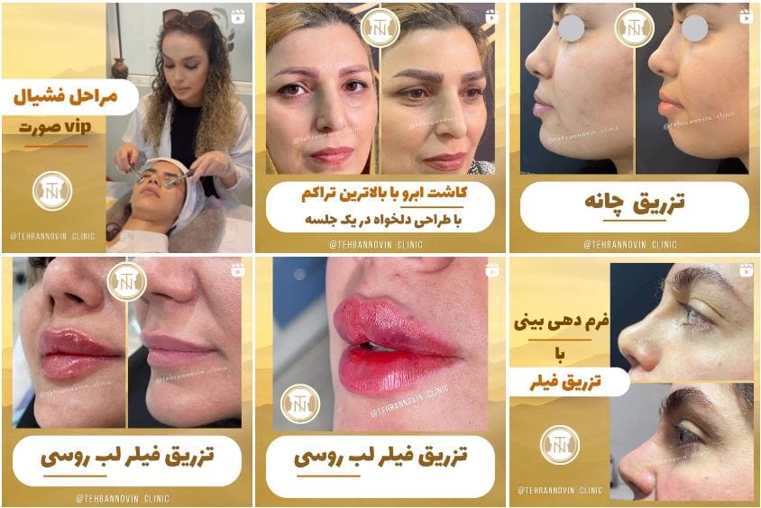 کلینیک زیبایی تهران نوین