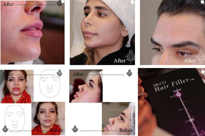 کلینیک لیزر دکتر زمانی