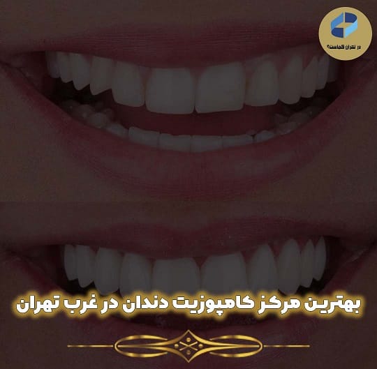 کامپوزیت غرب تهران
