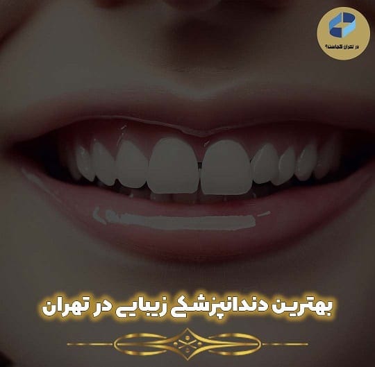 دندانپزشکی زیبایی در تهران
