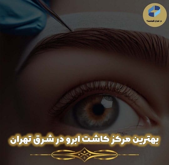کاشت ابرو در شرق تهران