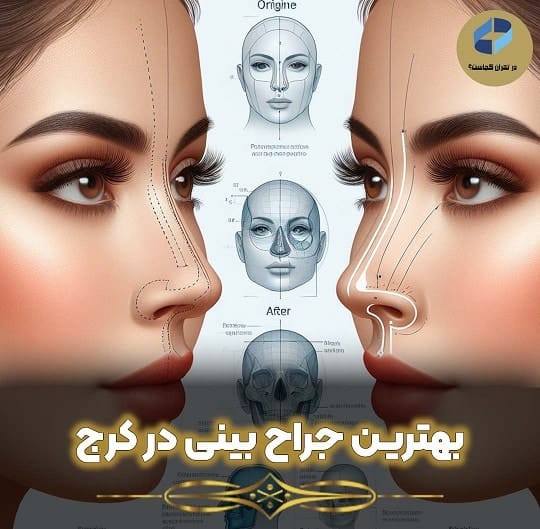 جراح بینی در کرج