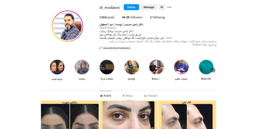 کلینیک دکتر رامین مدرسی: تخصص در کاشت مو و ابرو در اصفهان