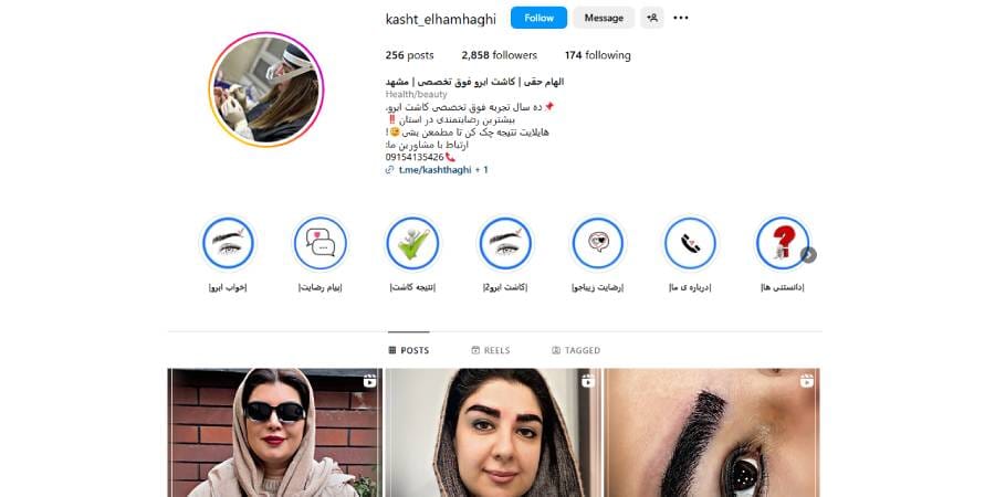 کلینیک تخصصی کاشت ابرو الهام حقی