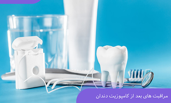 مراقبتهای بعد از درمان کامپوزیت دندان