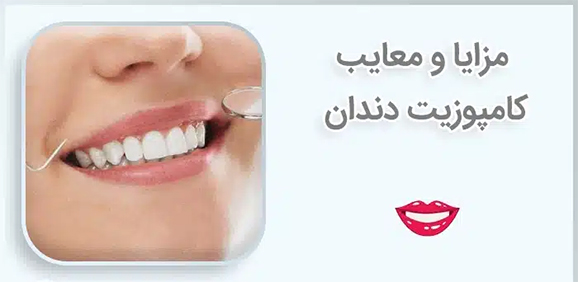 مزایا و معایب کامپوزیت دندان